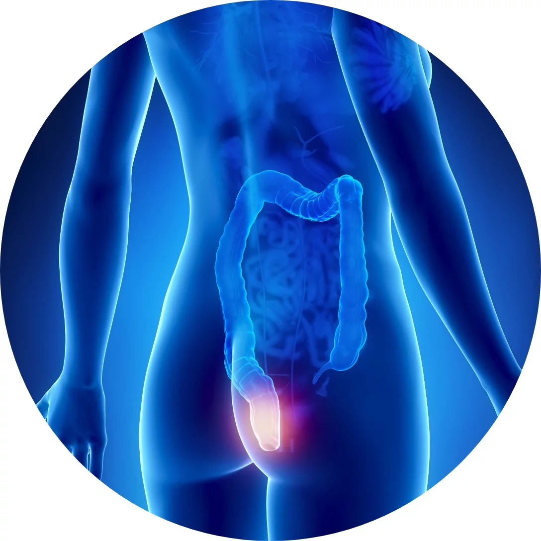 Rektum Kanseri Tehlikeli Mi?